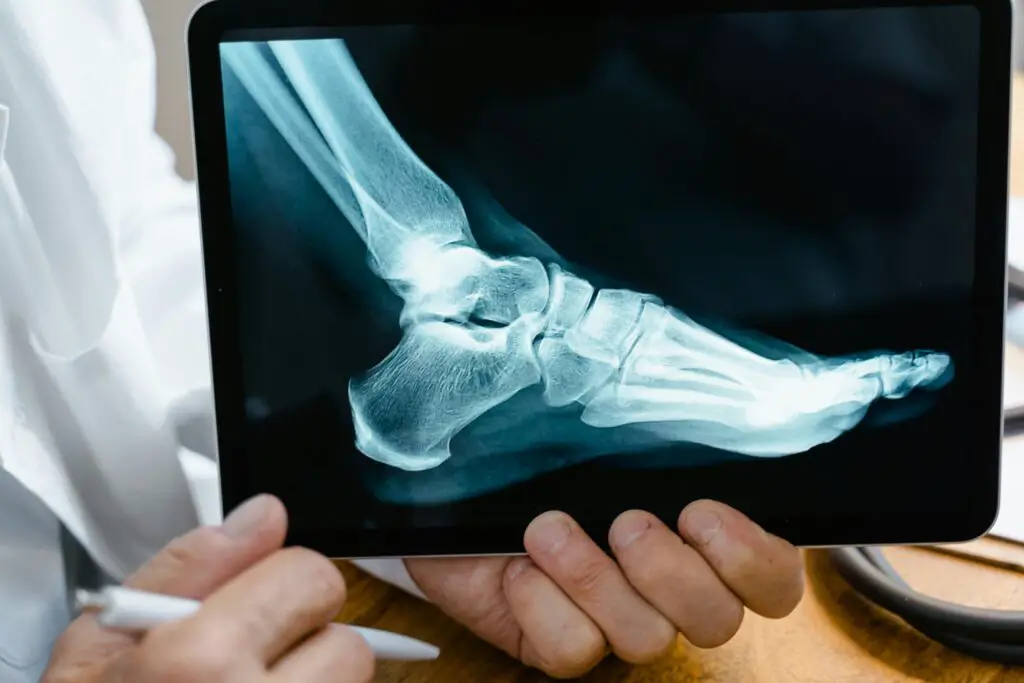 A doctor reviews a foot X-ray on a digital tablet in a medical consultation setting.